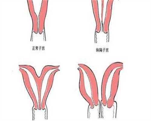 试管什么情况会胎停？试管什么情况会胎停呢？