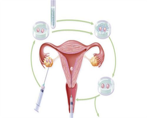 做试管婴儿前检查要仔细做后要学会调养身体