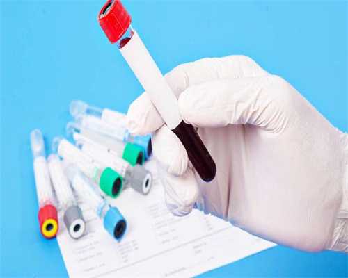 代孕包生孩子-精子畸形高能做试管吗