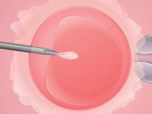 胚胎移植|试管婴儿胚胎移植前女性需要禁欲3到5天吗_试管移植前禁欲几天！